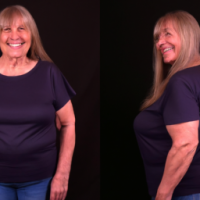 pictures of a middle aged woman before and after weight loss